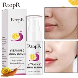 rtopr vitamin c