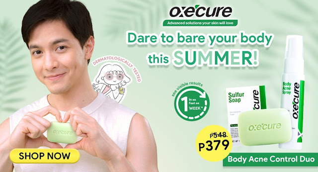 Get up to 35% off on Oxecure body acne control products from March 2-4 at Shopee Beauty